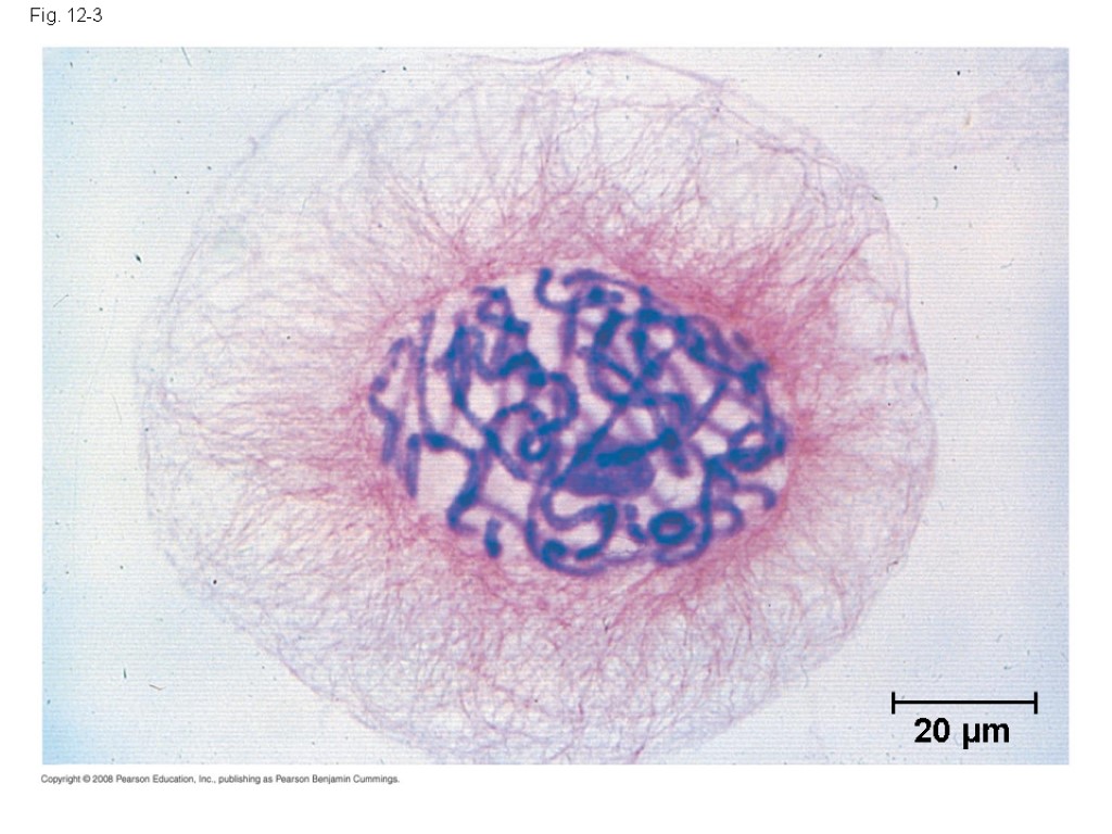 Fig. 12-3 20 µm